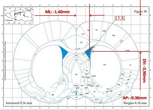 Пример локализации целевой точки «LV» по атласу головного мозга