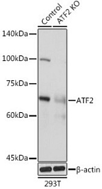 Антитела [KO Validated] ATF2 кроличьи, поликлональные, ABclonal, Китай