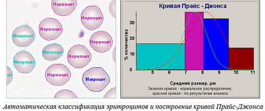 ПО для анализа крови, лейкоцитарная формула, эритроцитометрия, подсчет тромбоцитов, Аргус-Blood Фото 3