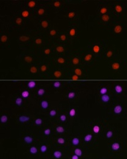 Иммунофлуоресцентный анализ клеток C6 с использованием [подтвержденного KO] Acetyl-HMGB1-K29 Rabbit pAb (A16002) в разведении 1:100 (линза 40x). Синий: DAPI для окрашивания ядер.