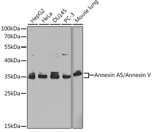 Антитела [KO Validated] Annexin A5/Annexin V кроличьи, поликлональные